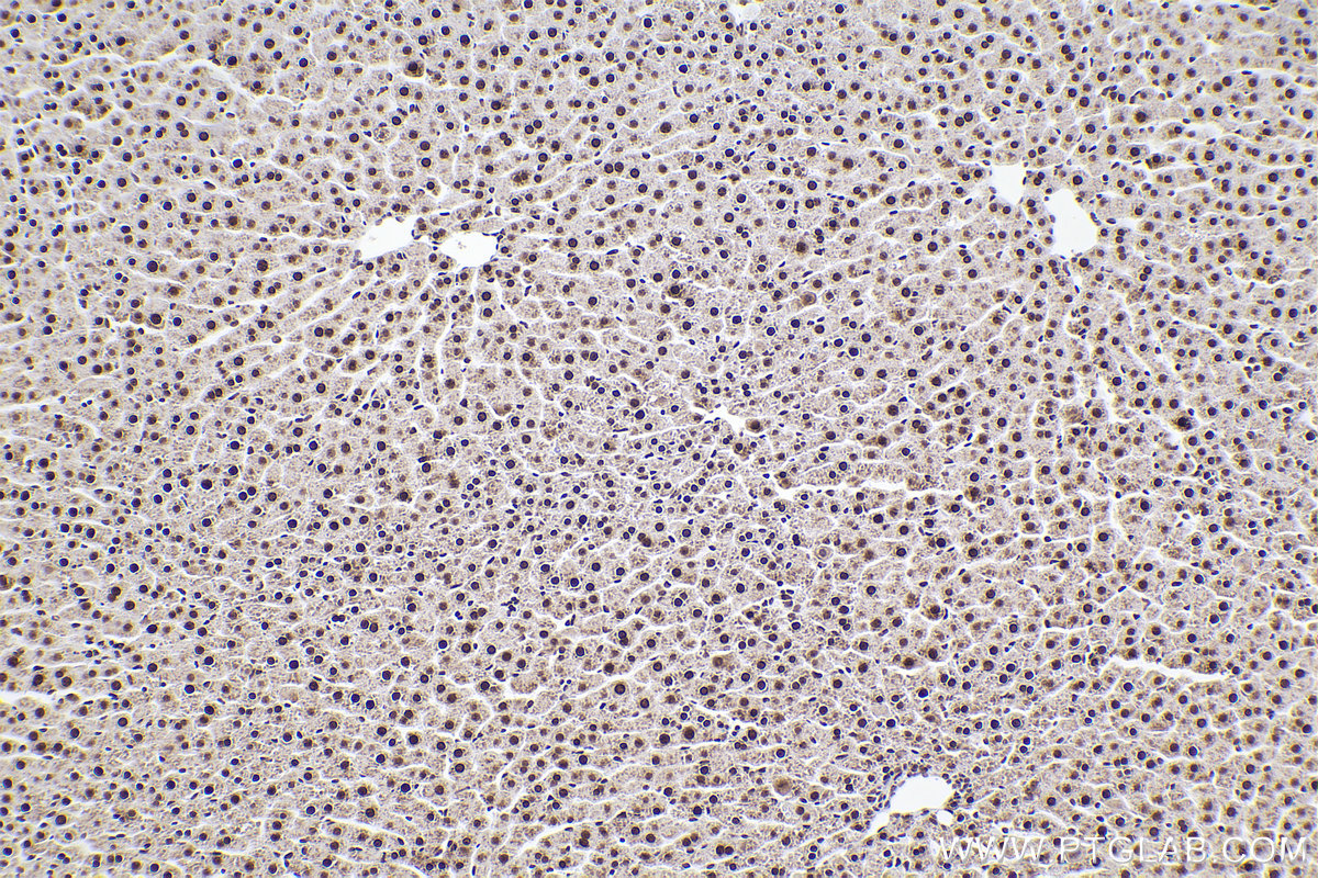 Immunohistochemical analysis of paraffin-embedded rat liver tissue slide using KHC2309 (HNRNPM IHC Kit).