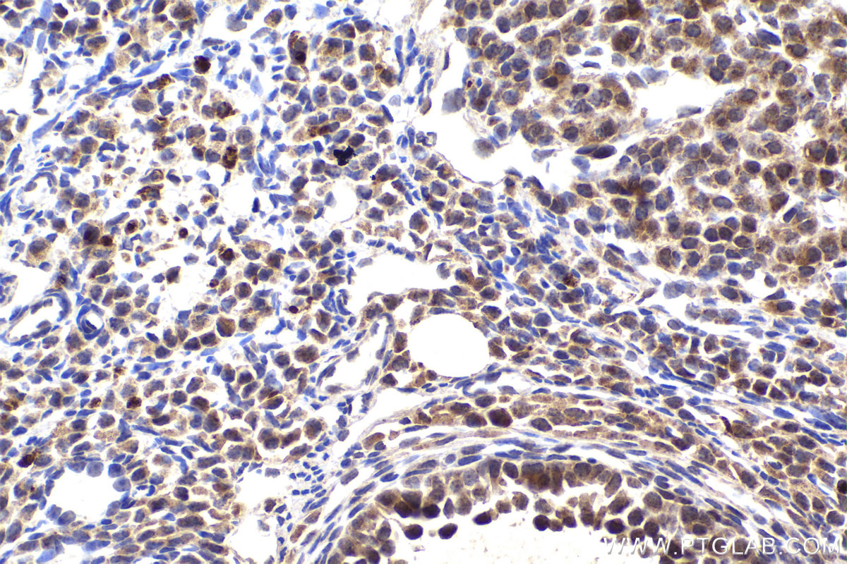 Immunohistochemical analysis of paraffin-embedded mouse ovary tissue slide using KHC2190 (HPGD IHC Kit).