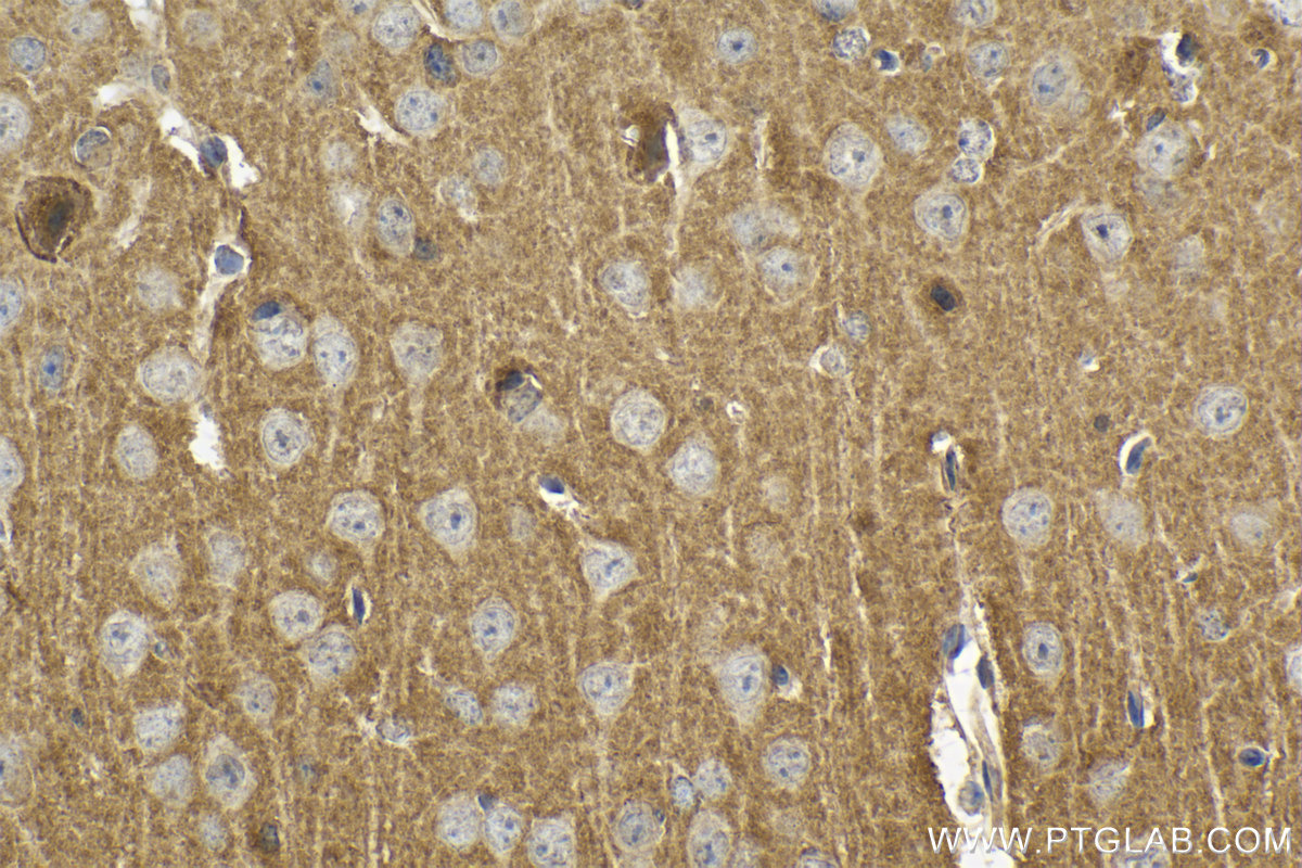 Immunohistochemical analysis of paraffin-embedded mouse brain tissue slide using KHC2155 (HRAS IHC Kit).