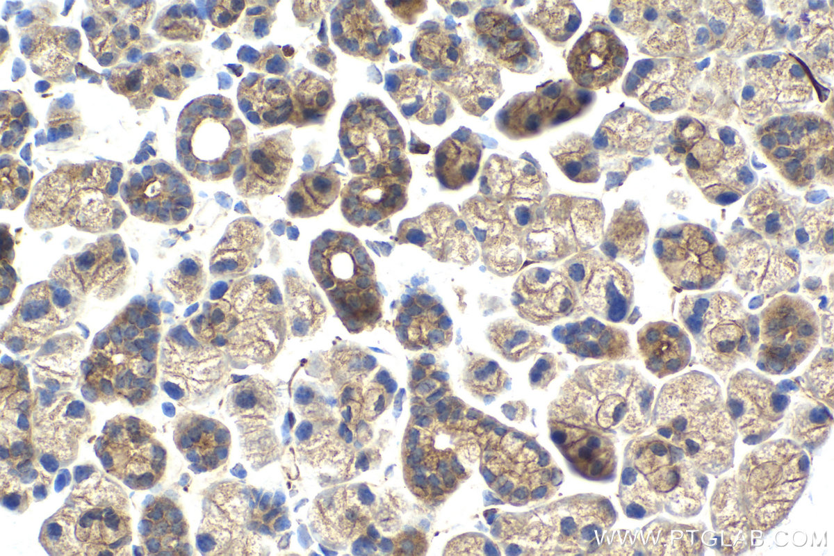Immunohistochemical analysis of paraffin-embedded mouse salivary gland tissue slide using KHC2155 (HRAS IHC Kit).