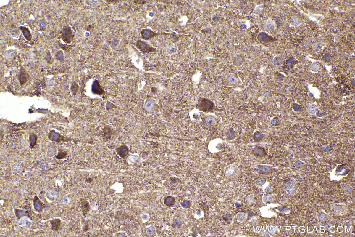 Immunohistochemical analysis of paraffin-embedded mouse brain tissue slide using KHC2340 (HSPE1 IHC Kit).