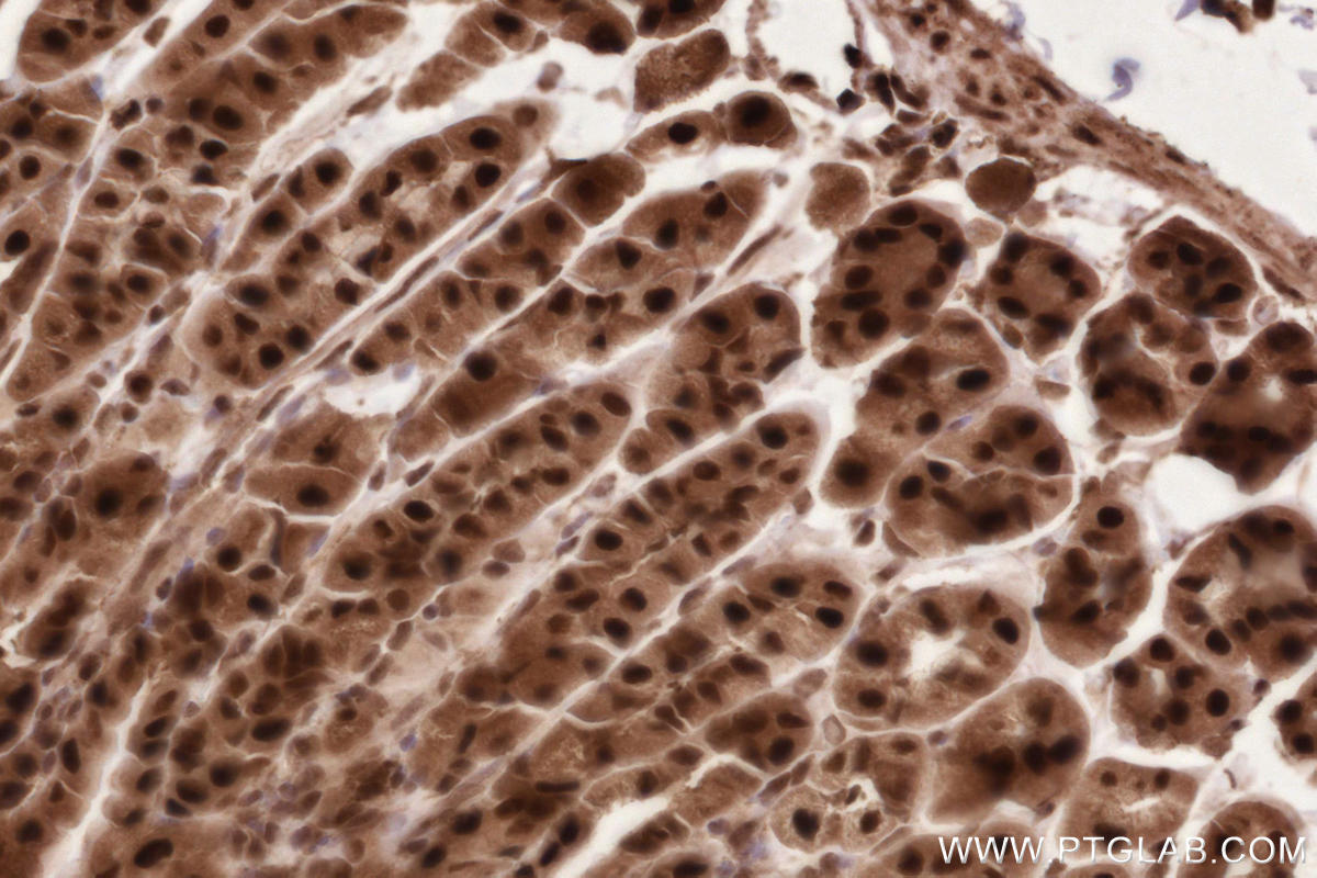 Immunohistochemical analysis of paraffin-embedded mouse stomach tissue slide using KHC2627 (HUWE1 IHC Kit).