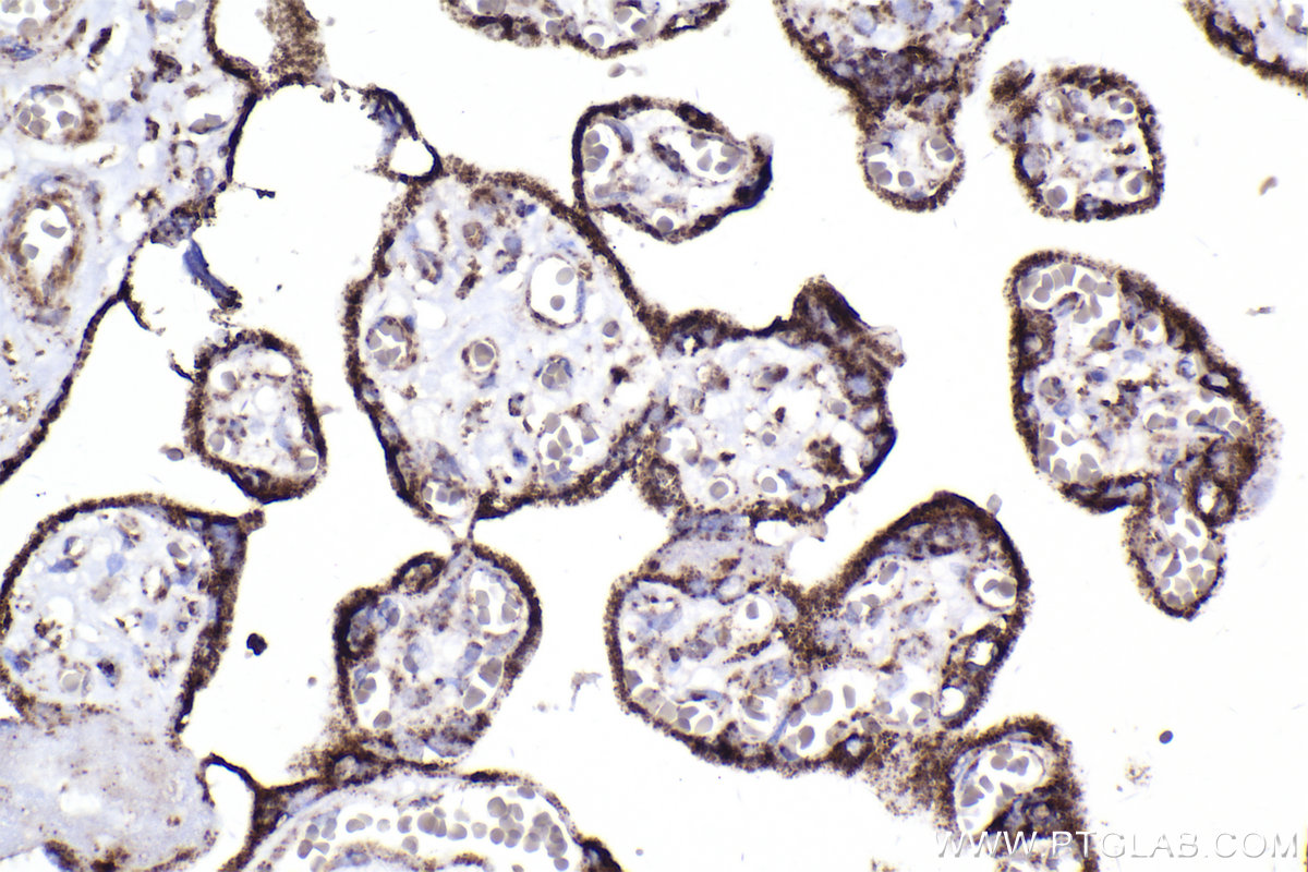 Immunohistochemical analysis of paraffin-embedded human placenta tissue slide using KHC2296 (IDH3A IHC Kit).