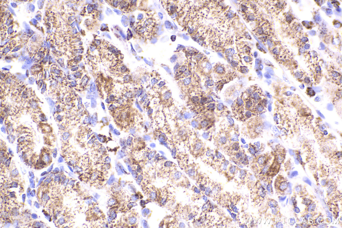 Immunohistochemical analysis of paraffin-embedded human stomach tissue slide using KHC2296 (IDH3A IHC Kit).