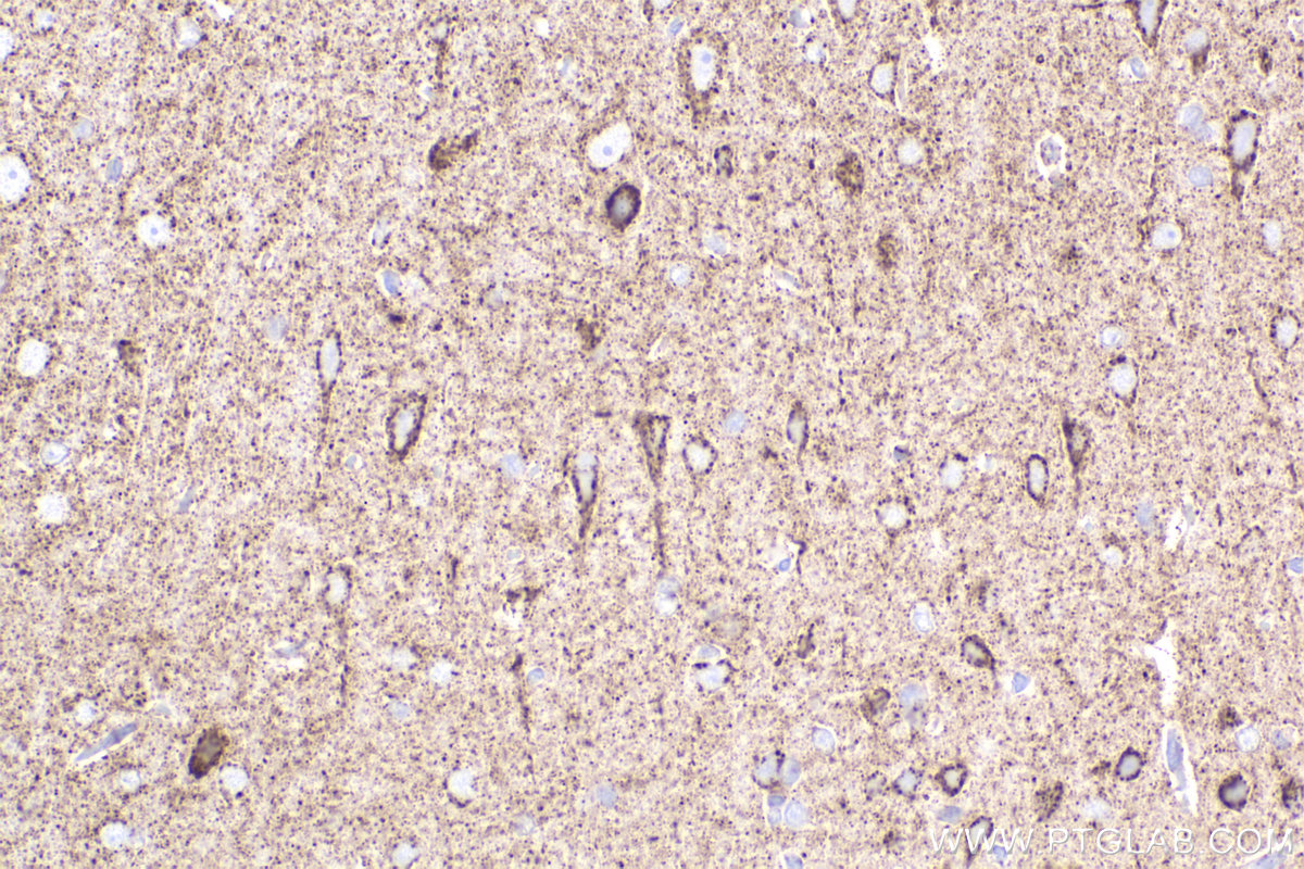 Immunohistochemical analysis of paraffin-embedded rat brain tissue slide using KHC2296 (IDH3A IHC Kit).