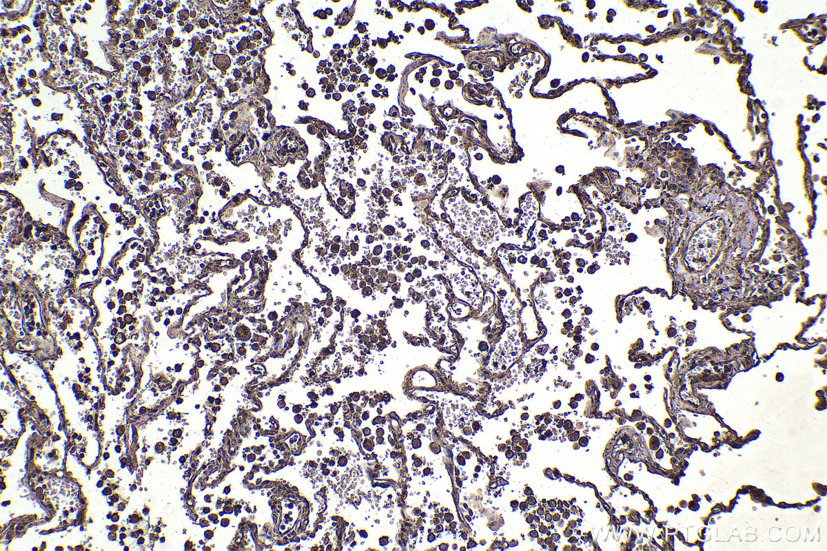 Immunohistochemical analysis of paraffin-embedded human lung tissue slide using KHC2186 (IDO1 IHC Kit).