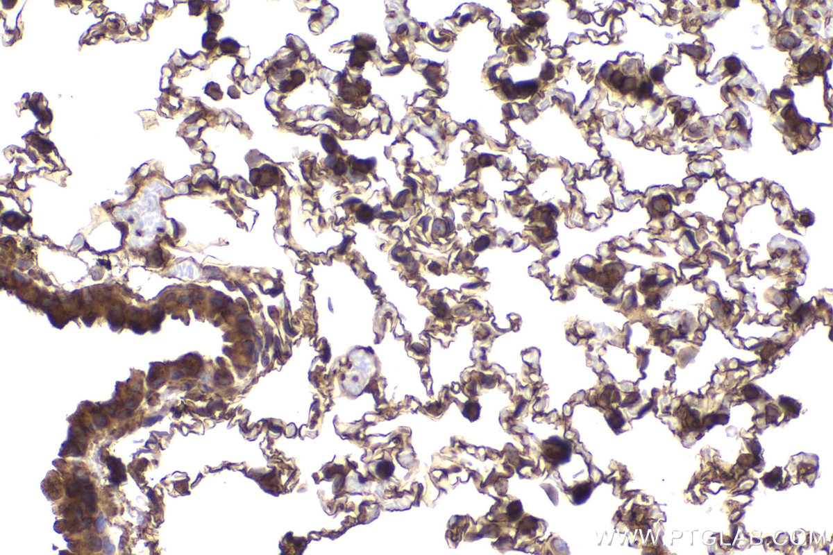 Immunohistochemical analysis of paraffin-embedded mouse lung tissue slide using KHC2186 (IDO1 IHC Kit).