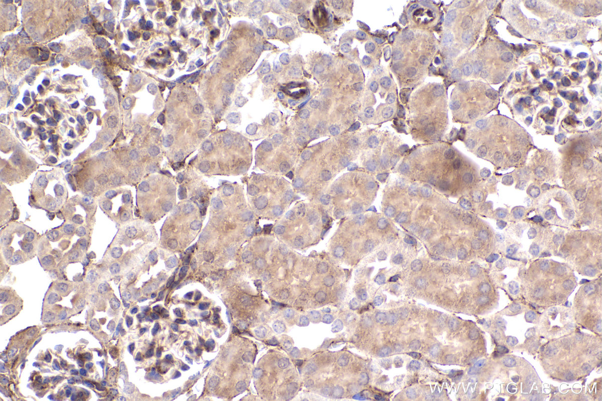 Immunohistochemical analysis of paraffin-embedded mouse kidney tissue slide using KHC2383 (IFITM2 IHC Kit).