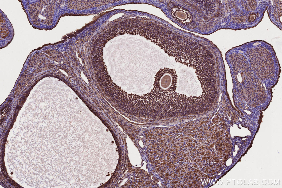 Immunohistochemical analysis of paraffin-embedded rat ovary tissue slide using KHC2656 (IFT20 IHC Kit).