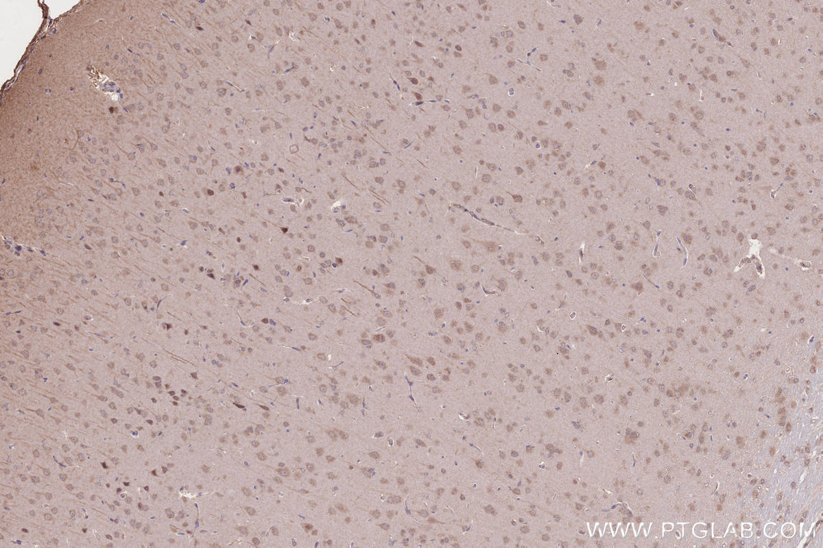 Immunohistochemical analysis of paraffin-embedded rat brain tissue slide using KHC2656 (IFT20 IHC Kit).