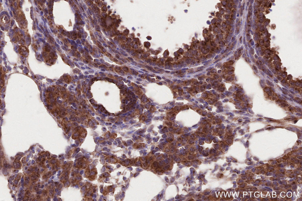 Immunohistochemical analysis of paraffin-embedded mouse ovary tissue slide using KHC2656 (IFT20 IHC Kit).