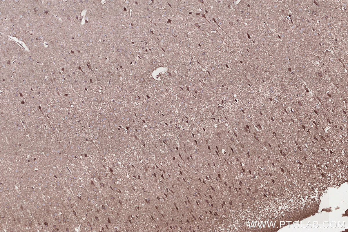 Immunohistochemical analysis of paraffin-embedded mouse brain tissue slide using KHC2656 (IFT20 IHC Kit).