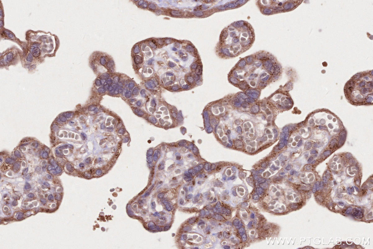 Immunohistochemical analysis of paraffin-embedded human placenta tissue slide using KHC2656 (IFT20 IHC Kit).