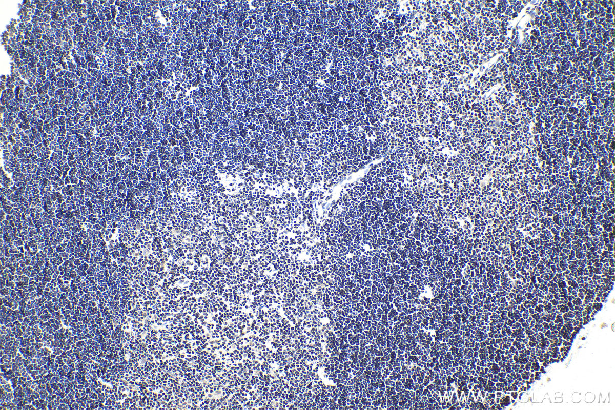 Immunohistochemical analysis of paraffin-embedded rat thymus tissue slide using KHC1995 (IKZF3 IHC Kit).