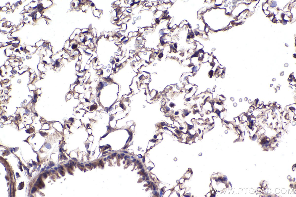 Immunohistochemical analysis of paraffin-embedded rat lung tissue slide using KHC2406 (IL1RL1/ST2 IHC Kit).