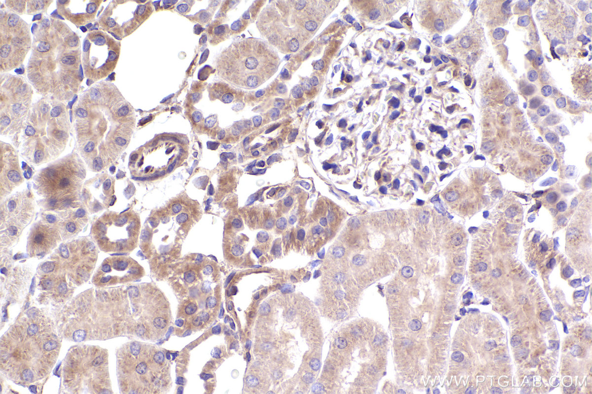 Immunohistochemical analysis of paraffin-embedded rat kidney tissue slide using KHC2406 (IL1RL1/ST2 IHC Kit).