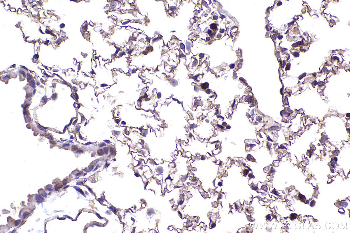 Immunohistochemical analysis of paraffin-embedded mouse lung tissue slide using KHC2406 (IL1RL1/ST2 IHC Kit).