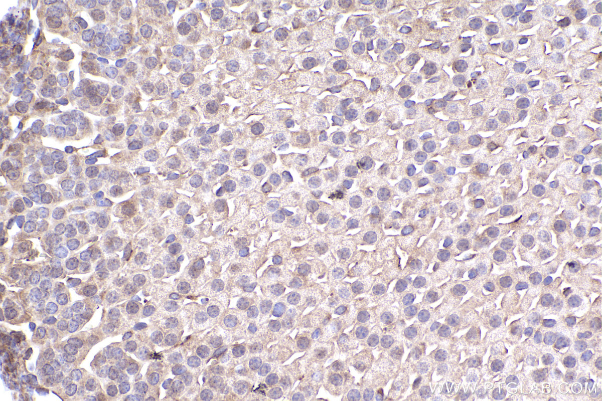 Immunohistochemical analysis of paraffin-embedded mouse adrenal gland tissue slide using KHC2406 (IL1RL1/ST2 IHC Kit).