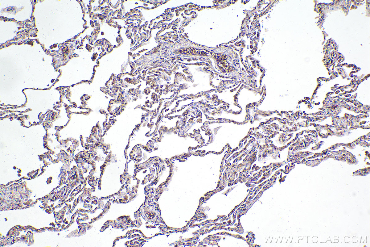 Immunohistochemical analysis of paraffin-embedded human lung tissue slide using KHC2406 (IL1RL1/ST2 IHC Kit).