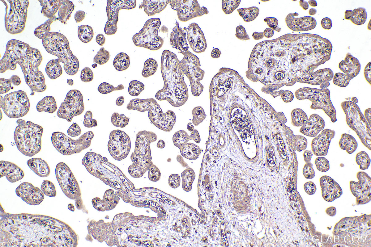 Immunohistochemical analysis of paraffin-embedded human placenta tissue slide using KHC2406 (IL1RL1/ST2 IHC Kit).