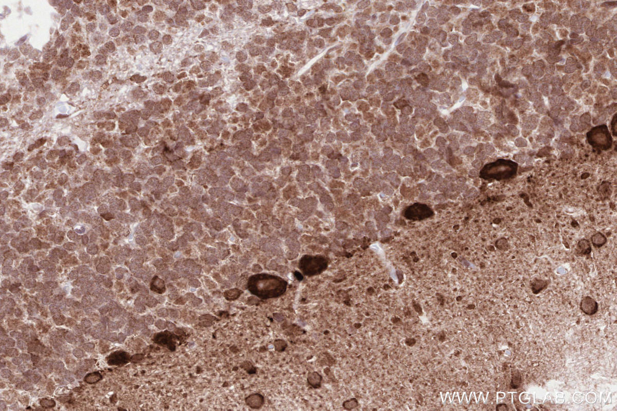 Immunohistochemical analysis of paraffin-embedded rat cerebellum tissue slide using KHC2586 (INTS5 IHC Kit).