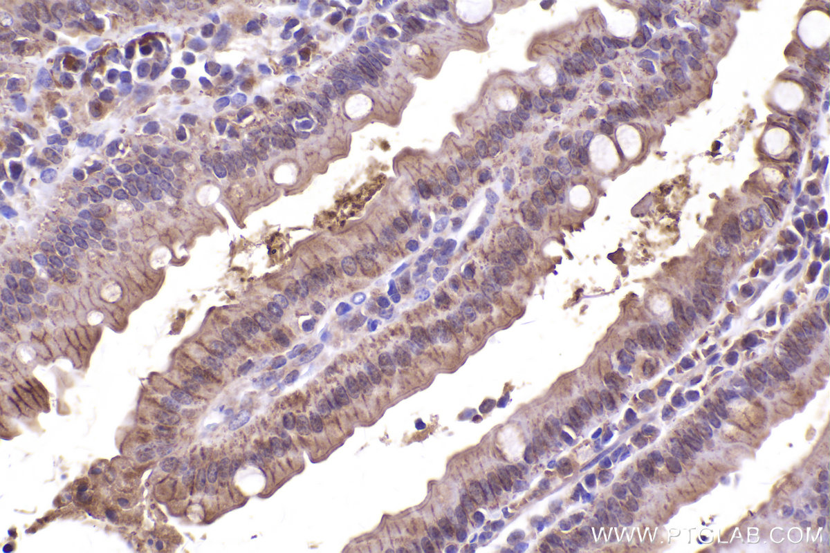 Immunohistochemical analysis of paraffin-embedded mouse small intestine tissue slide using KHC2436 (IQGAP2 IHC Kit).