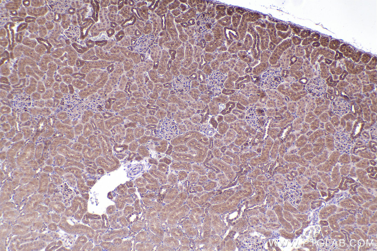 Immunohistochemical analysis of paraffin-embedded rat kidney tissue slide using KHC2436 (IQGAP2 IHC Kit).