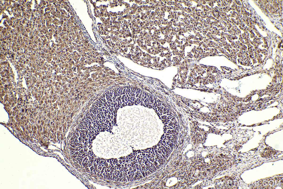 Immunohistochemical analysis of paraffin-embedded rat ovary tissue slide using KHC2304 (IRAK1 IHC Kit).