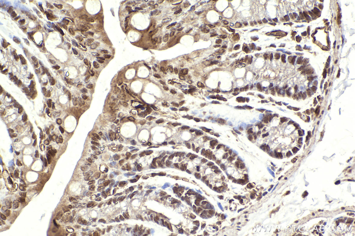 Immunohistochemical analysis of paraffin-embedded mouse colon tissue slide using KHC2304 (IRAK1 IHC Kit).