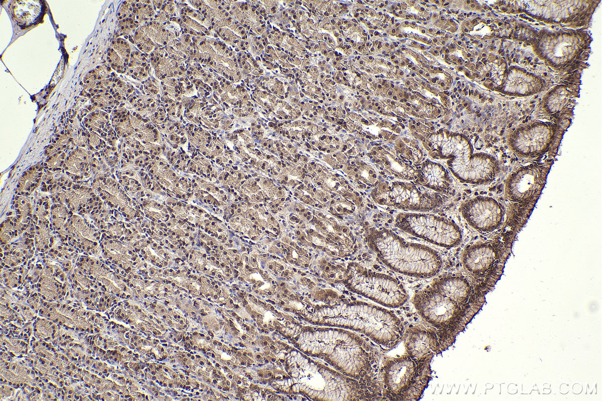 Immunohistochemical analysis of paraffin-embedded human stomach tissue slide using KHC2304 (IRAK1 IHC Kit).