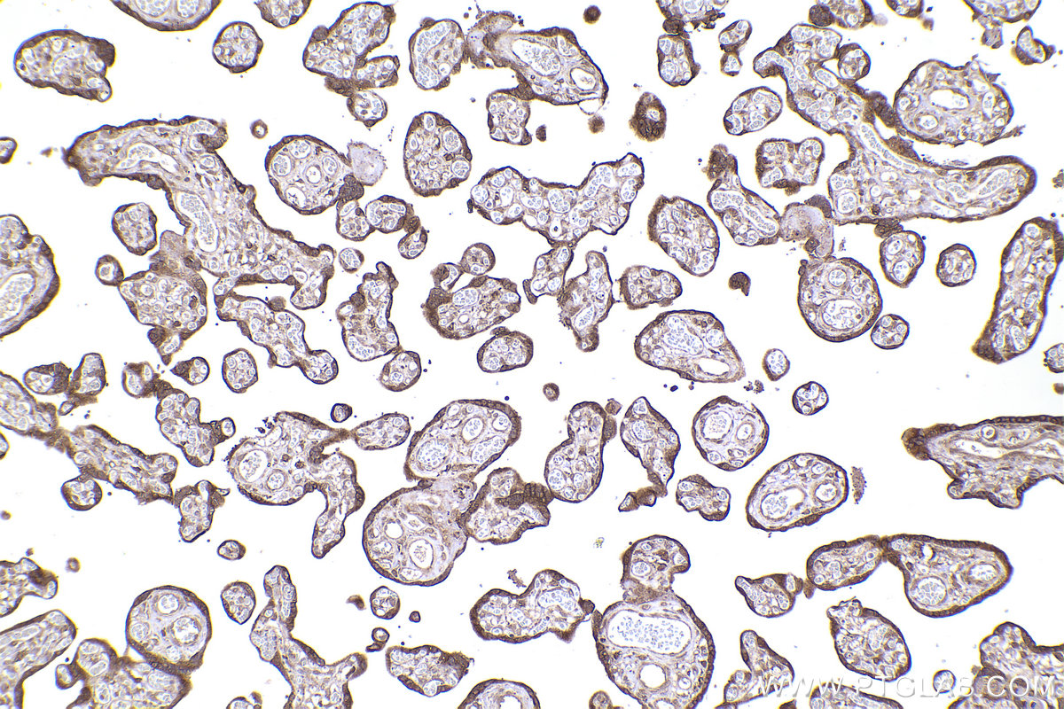 Immunohistochemical analysis of paraffin-embedded human placenta tissue slide using KHC2281 (IREB2 IHC Kit).