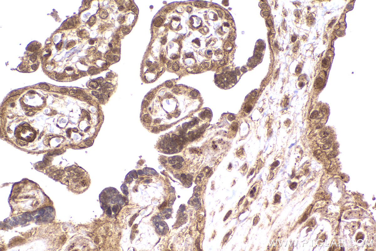 Immunohistochemical analysis of paraffin-embedded human placenta tissue slide using KHC2176 (IRF1 IHC Kit).