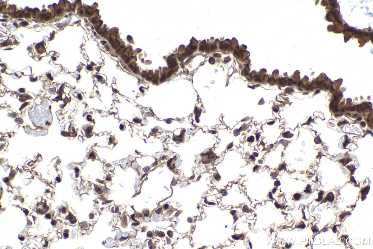 Immunohistochemical analysis of paraffin-embedded mouse lung tissue slide using KHC2176 (IRF1 IHC Kit).