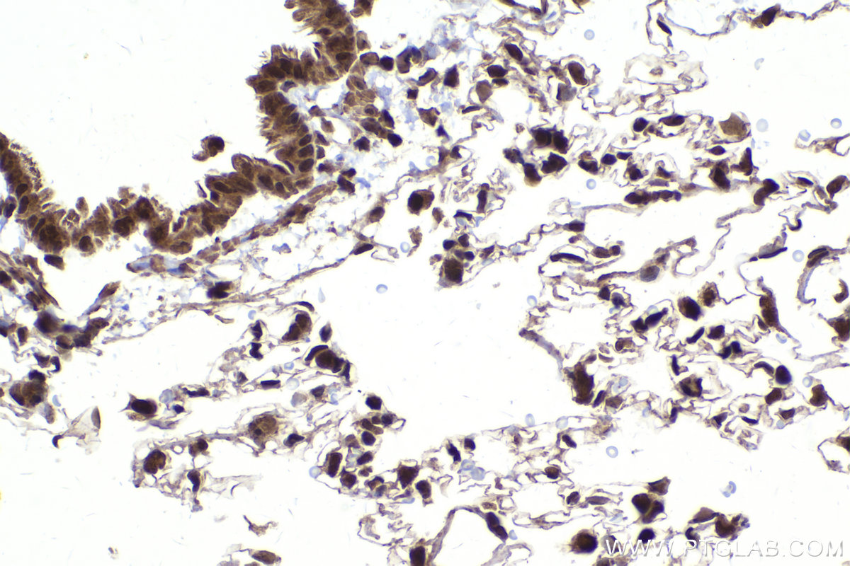 Immunohistochemical analysis of paraffin-embedded rat lung tissue slide using KHC2176 (IRF1 IHC Kit).