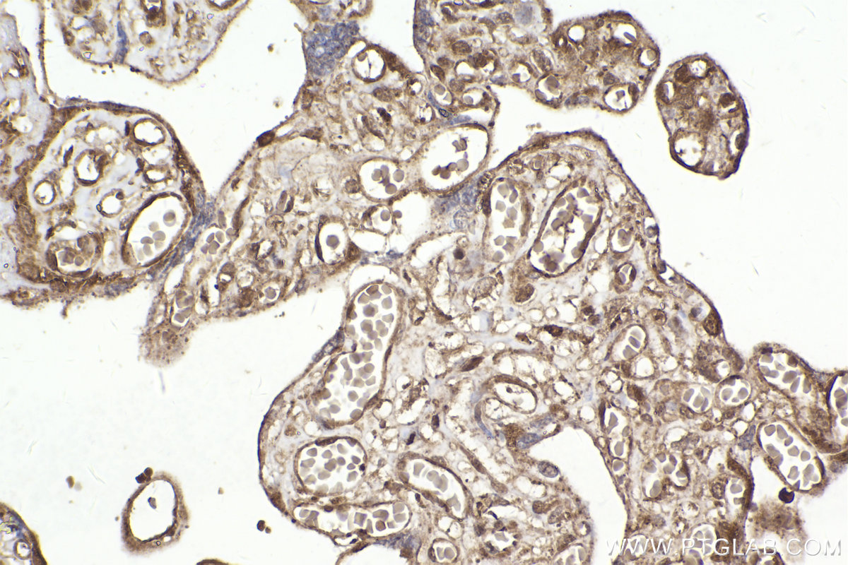 Immunohistochemical analysis of paraffin-embedded human placenta tissue slide using KHC2322 (IST1 IHC Kit).