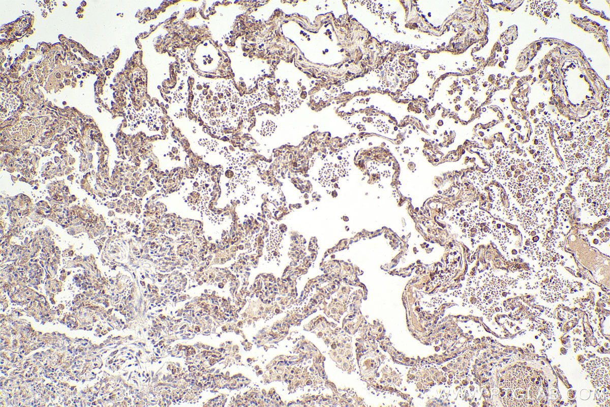 Immunohistochemical analysis of paraffin-embedded human lung tissue slide using KHC2322 (IST1 IHC Kit).