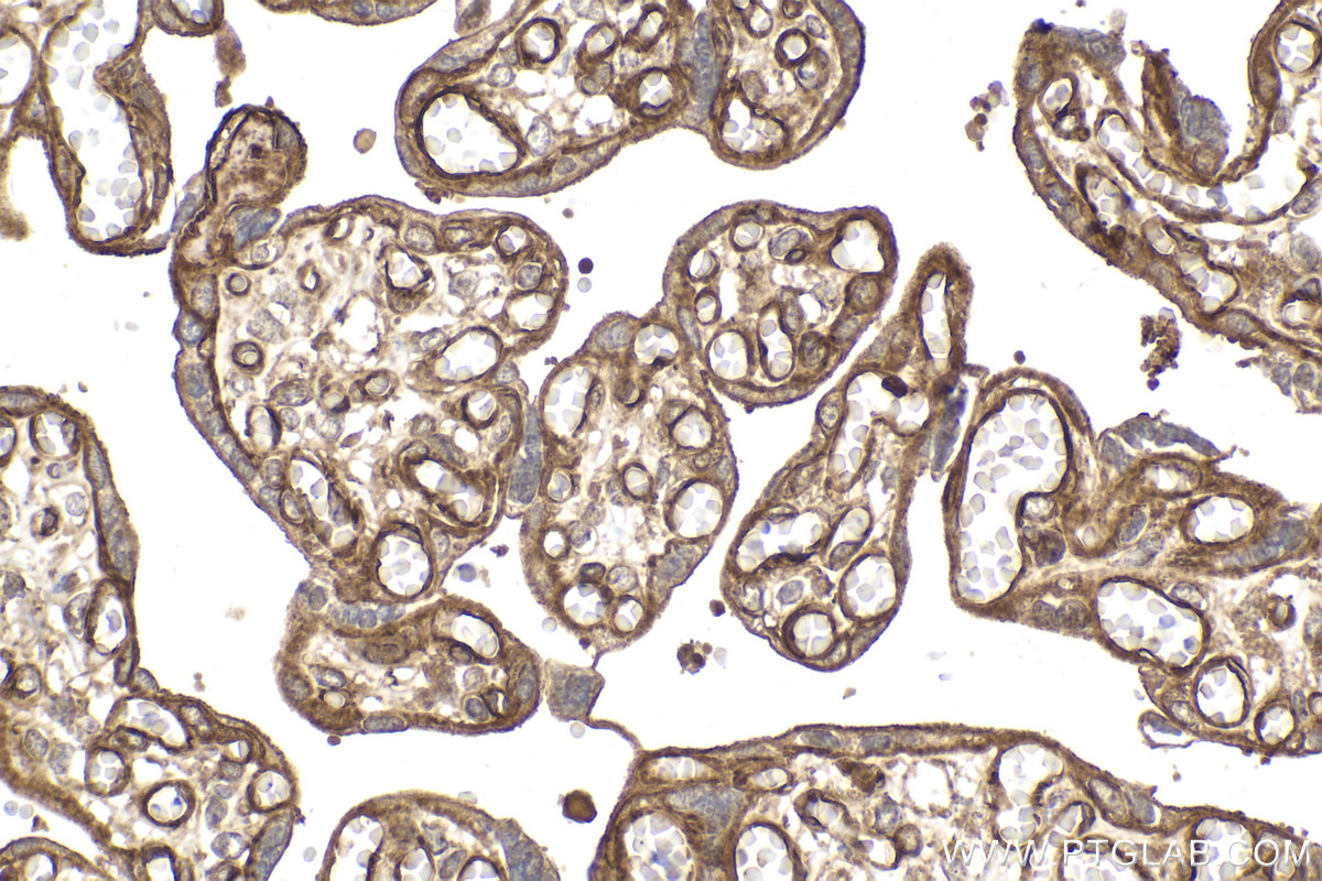 Immunohistochemical analysis of paraffin-embedded human placenta tissue slide using KHC2163 (ITGB1/CD29 IHC Kit).