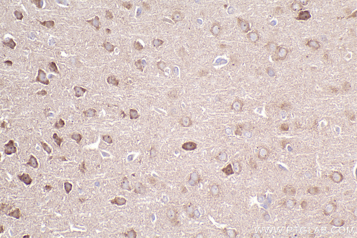 Immunohistochemical analysis of paraffin-embedded rat brain tissue slide using KHC2498 (Intersectin 1/ITSN1 IHC Kit).