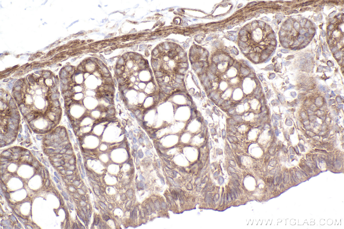 Immunohistochemical analysis of paraffin-embedded rat colon tissue slide using KHC2498 (Intersectin 1/ITSN1 IHC Kit).