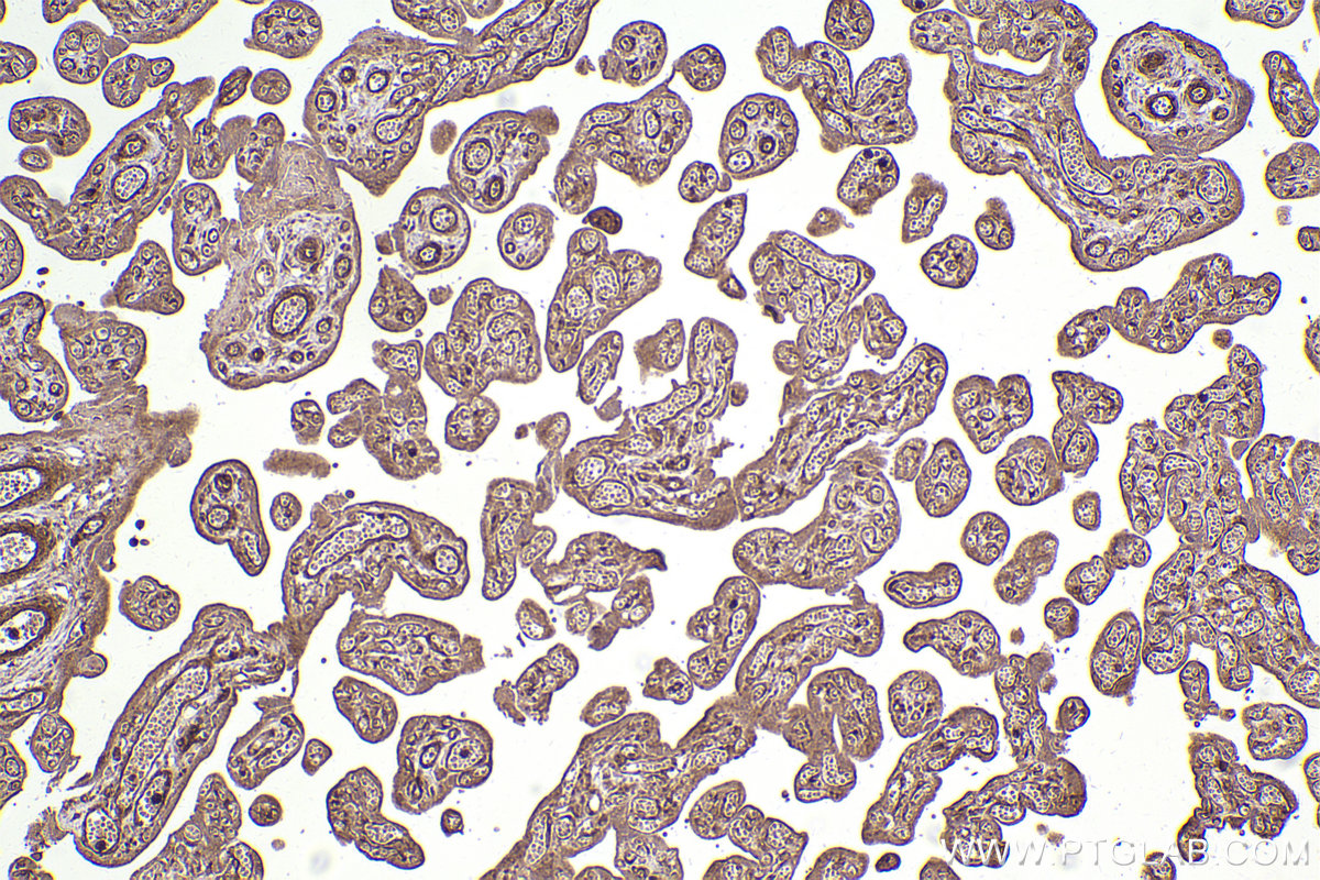 Immunohistochemical analysis of paraffin-embedded human placenta tissue slide using KHC2569 (KANK2 IHC Kit).