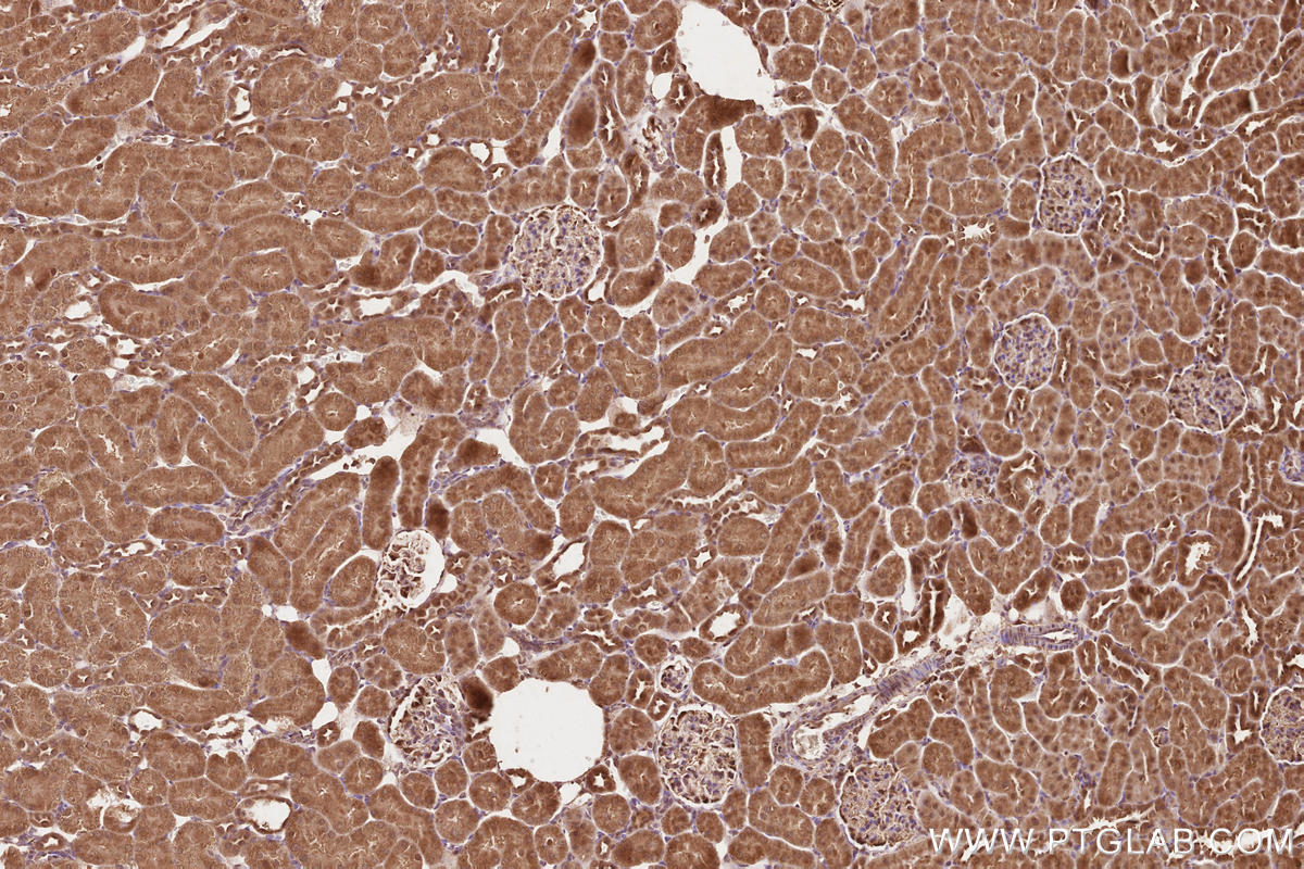 Immunohistochemical analysis of paraffin-embedded rat kidney tissue slide using KHC2569 (KANK2 IHC Kit).