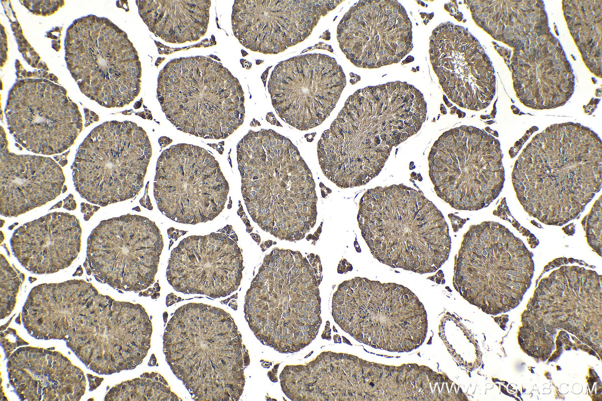 Immunohistochemical analysis of paraffin-embedded mouse testis tissue slide using KHC2113 (KATNA1 IHC Kit).