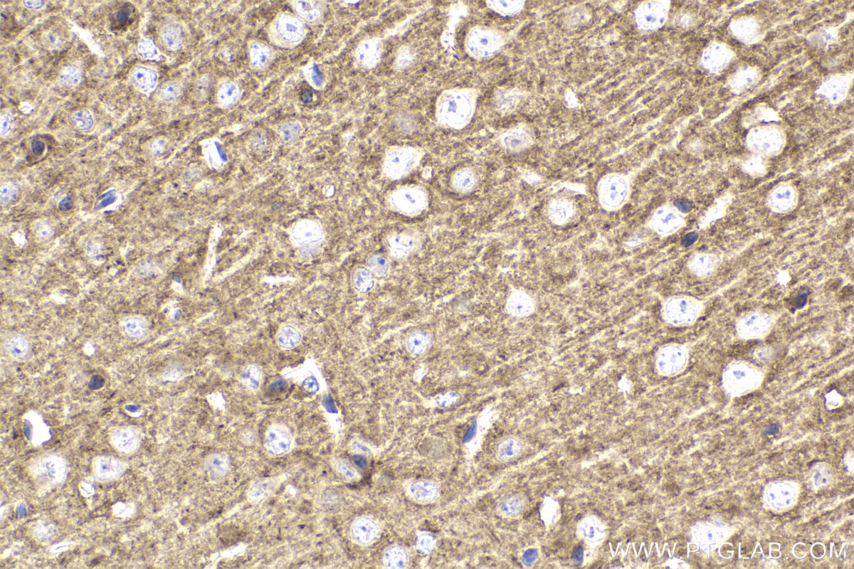 Immunohistochemical analysis of paraffin-embedded mouse brain tissue slide using KHC2192 (KCNA2 IHC Kit).