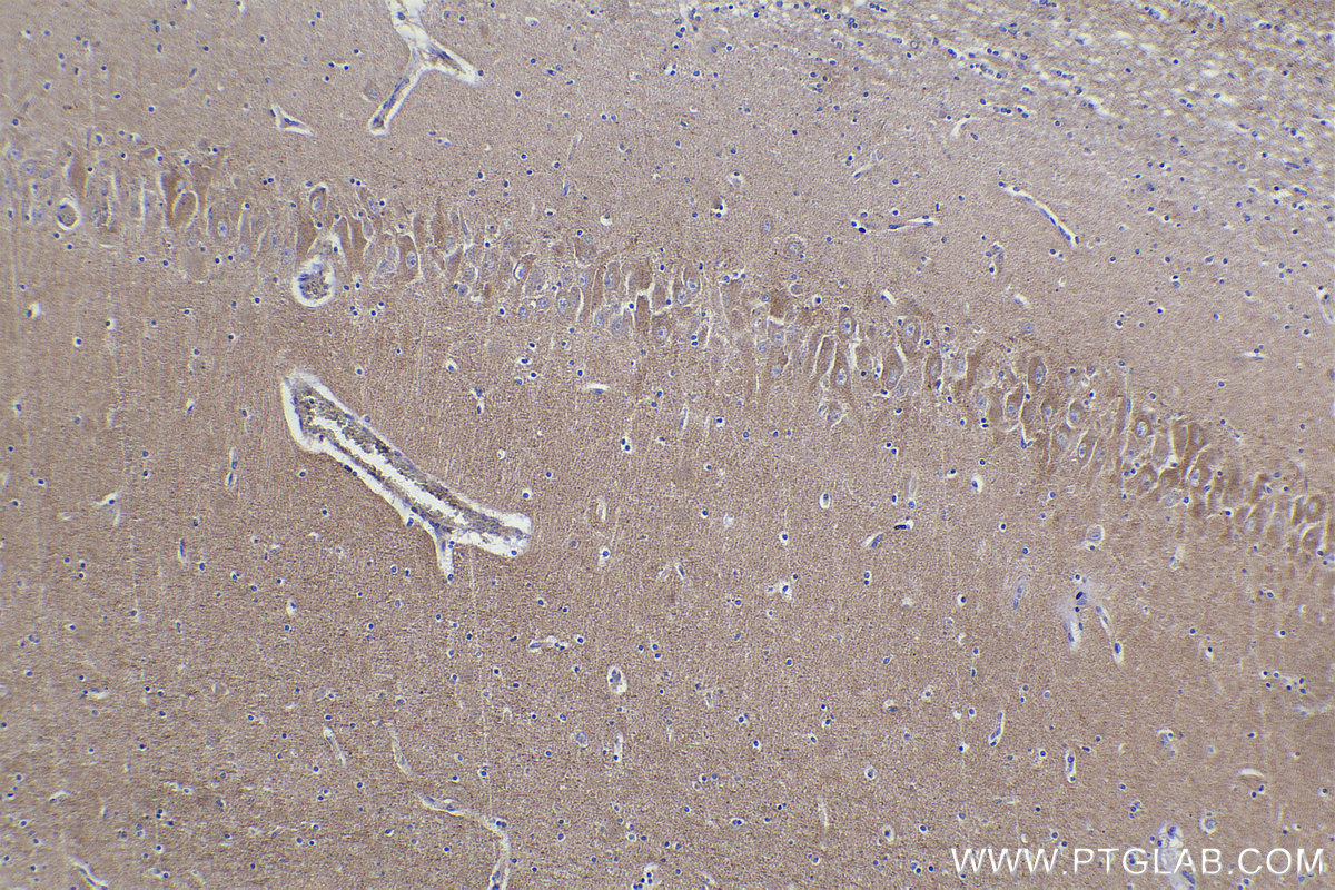 Immunohistochemical analysis of paraffin-embedded human brain tissue slide using KHC2192 (KCNA2 IHC Kit).