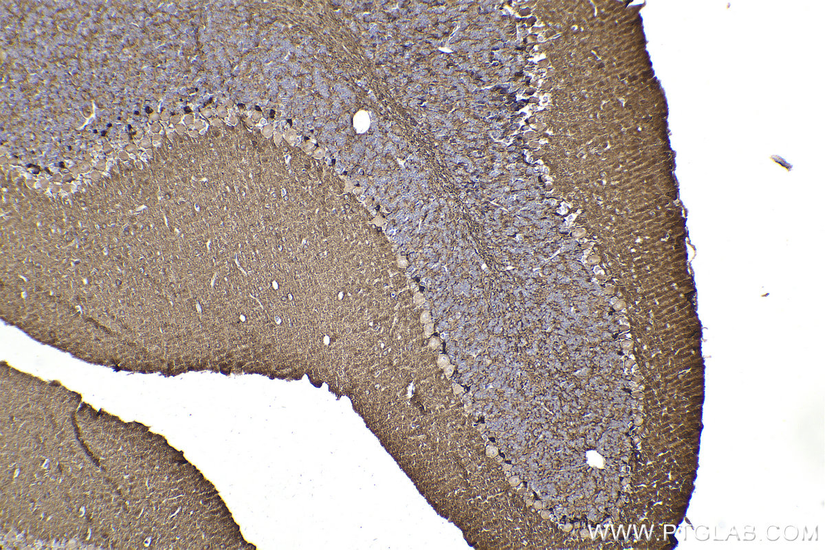 Immunohistochemical analysis of paraffin-embedded mouse cerebellum tissue slide using KHC2192 (KCNA2 IHC Kit).