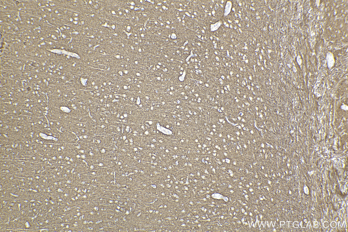 Immunohistochemical analysis of paraffin-embedded rat brain tissue slide using KHC2192 (KCNA2 IHC Kit).