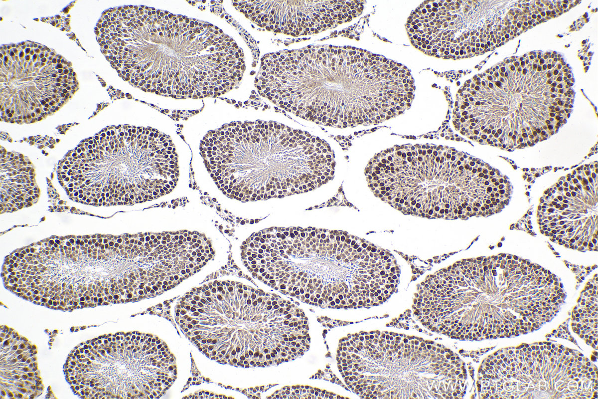 Immunohistochemical analysis of paraffin-embedded rat testis tissue slide using KHC2104 (KIN IHC Kit).