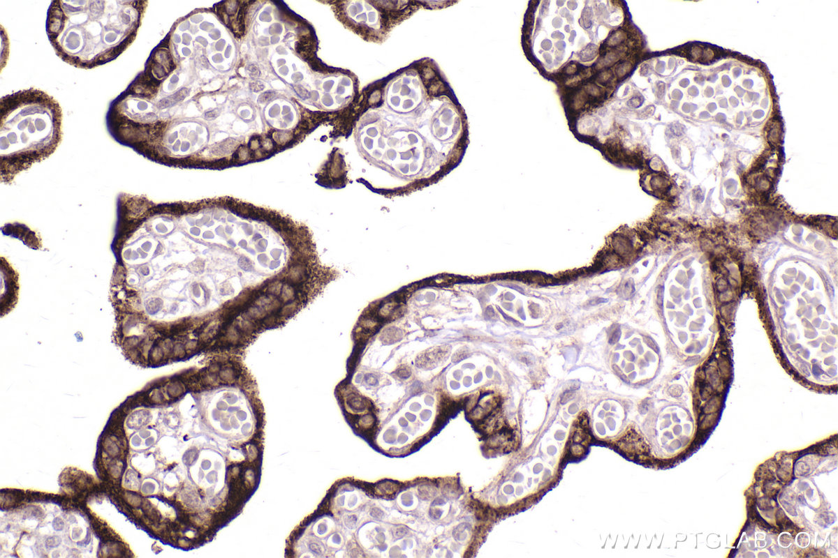 Immunohistochemical analysis of paraffin-embedded human placenta tissue slide using KHC2495 (KISS1 IHC Kit).