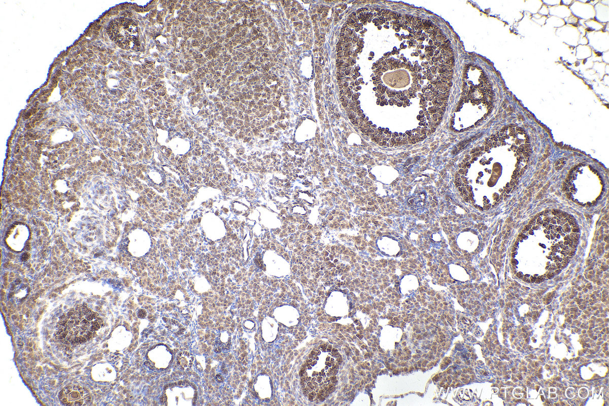 Immunohistochemical analysis of paraffin-embedded mouse ovary tissue slide using KHC2535 (KLHL22 IHC Kit).