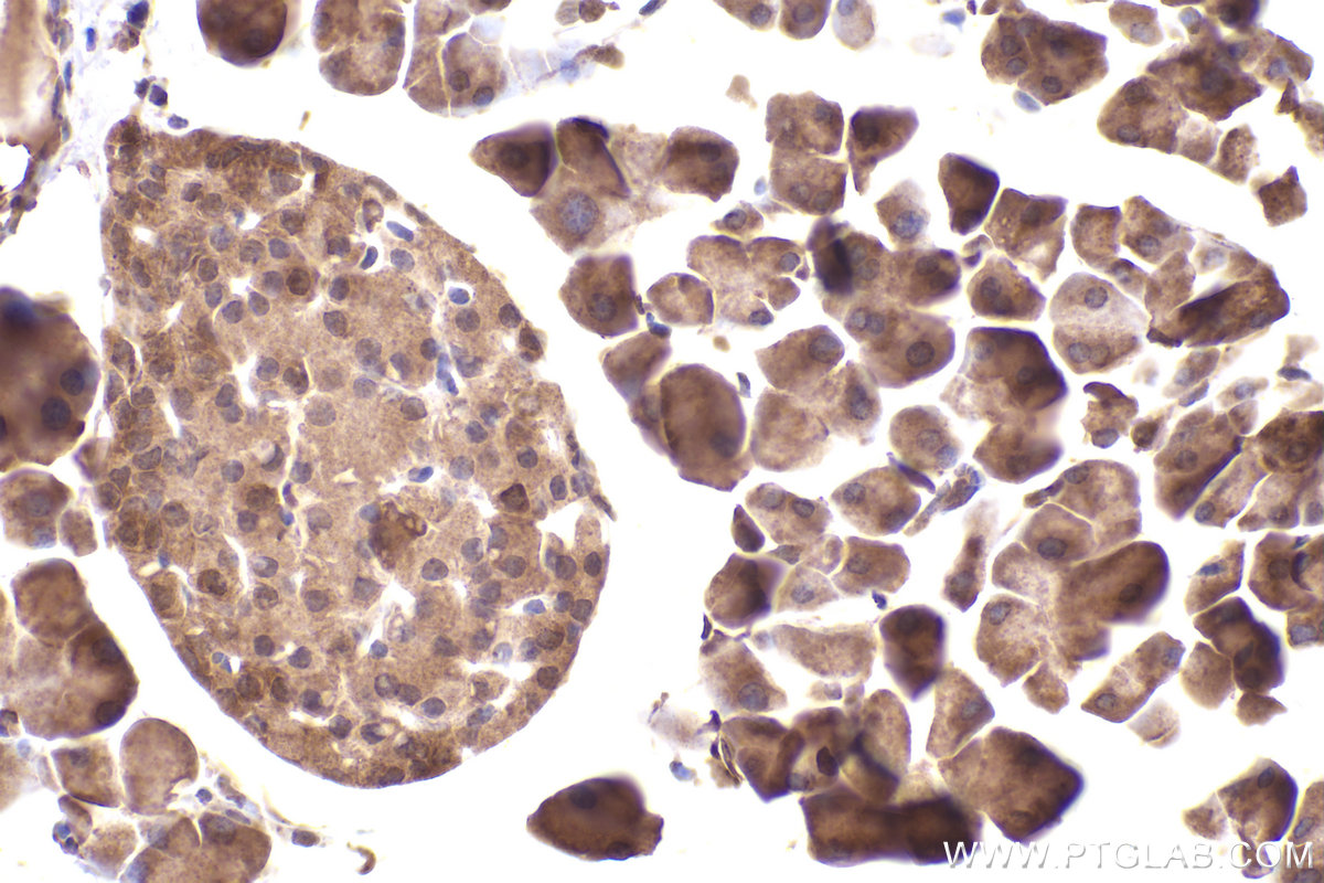 Immunohistochemical analysis of paraffin-embedded mouse pancreas tissue slide using KHC2535 (KLHL22 IHC Kit).